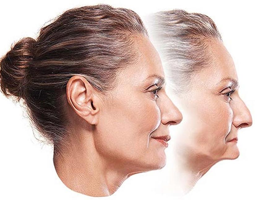 falta de dientes - dentista santa maria