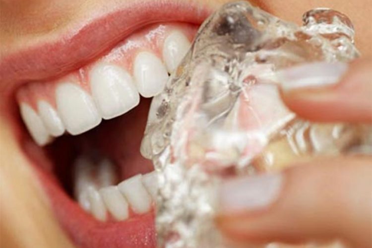 hábitos-terribles-para-los-dientes