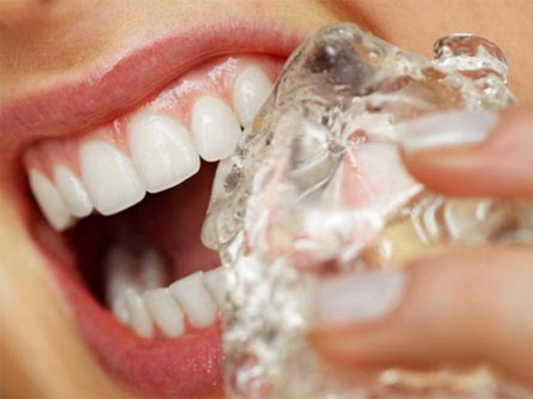 hábitos-terribles-para-los-dientes