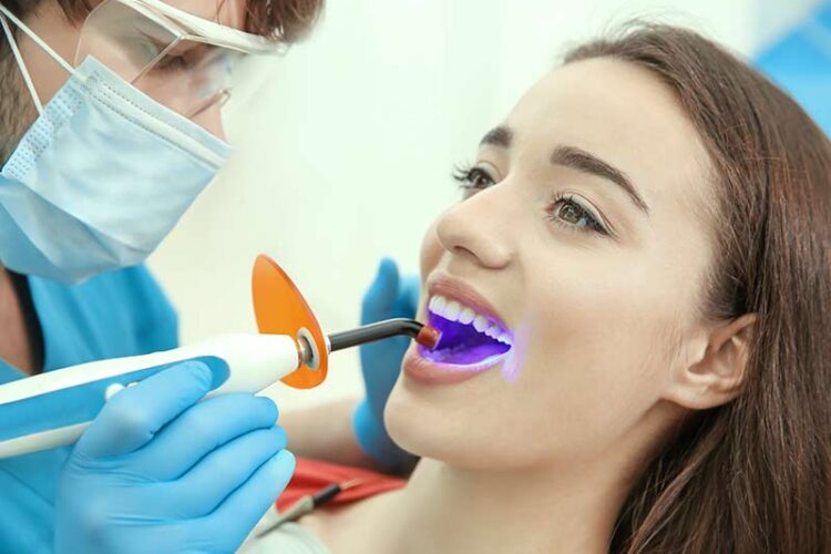 dental_filling_dentist_santa_maria
