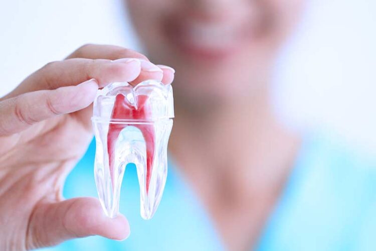 ft_root_canal_therapy