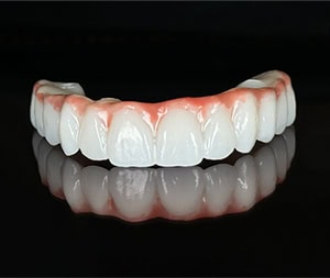 zirconia bridge full arch dental implants santa maria dentist Mai dental
