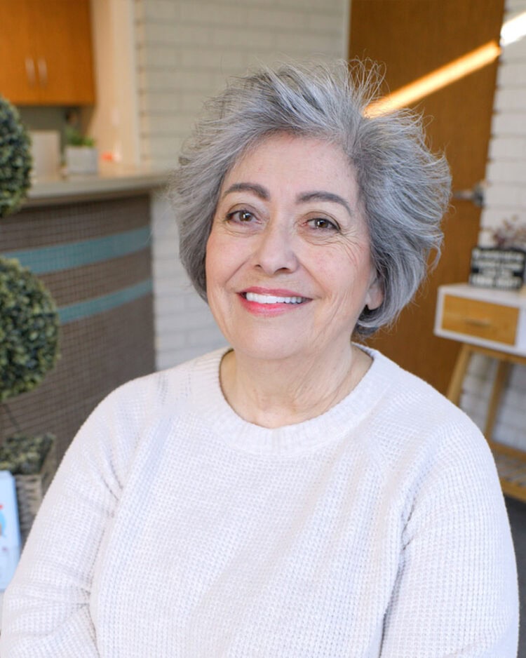 Natural-looking smile result after full-arch dental implant treatment in Santa Maria