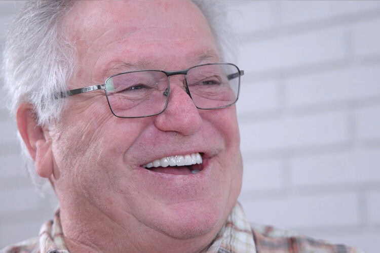 Male patient smiling confidently after dental implant restoration in Santa Maria